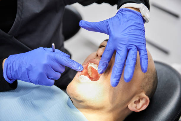 Best Chipped Tooth Repair Near Me  in Carthage, TN